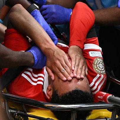 What Injury Did Jamal Musiala Suffer and How Long Will He Be Out for Bayern Munich?